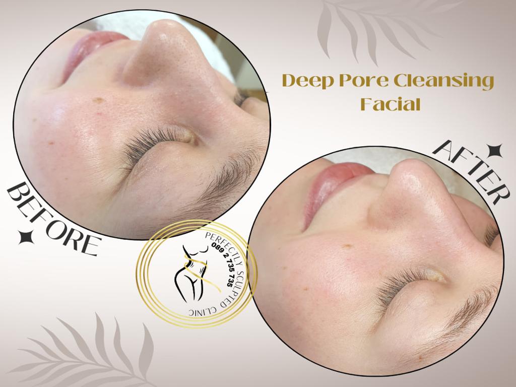 Advanced Skin Treatment