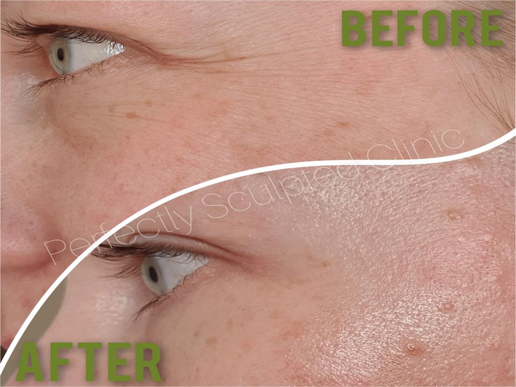 Advanced Skin Treatment